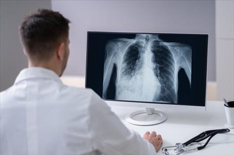 Ockovani pneumokoky