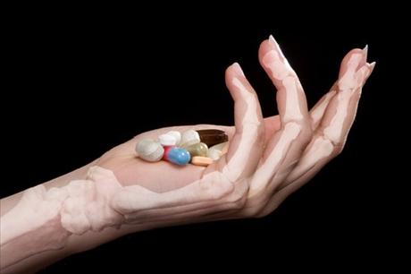 O ne��douc�m ��inku l�ku dejte v�d�t!