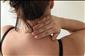 Zamrzl� rameno a blok�dy p�te�e je t�eba l��it ihned