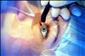 Rou�ka byla tou posledn� kapkou: Pry� s br�lemi!